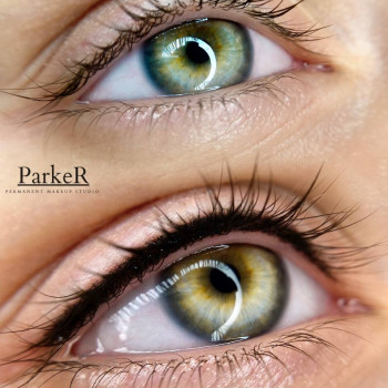 Міжвійка "до" та "після"