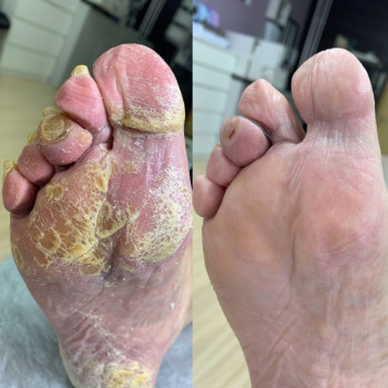 PodoPlex, Одесса Фото - 14