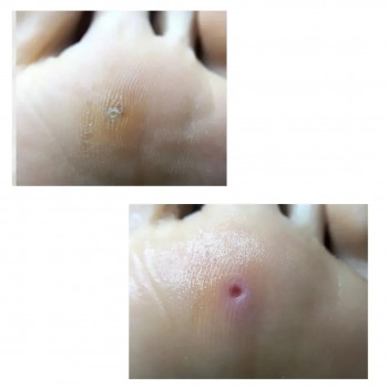 PodoPlex, Одесса Фото - 41