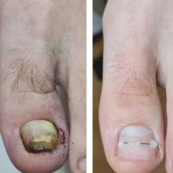 PodoPlex, Одесса Фото - 52