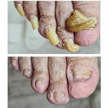 PodoPlex, Одесса Фото - 54