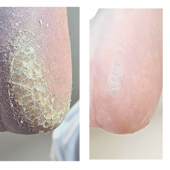 PodoPlex, Одесса Фото - 58