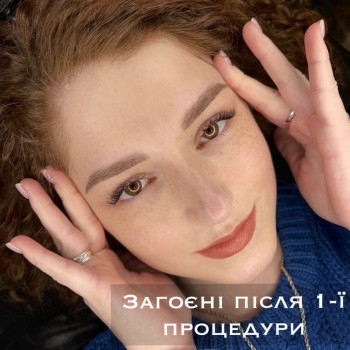 Загоєні брови