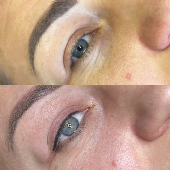 Перманентний татуаж
                    Косметолог-инъекционист Світлана Каменец-Подольский