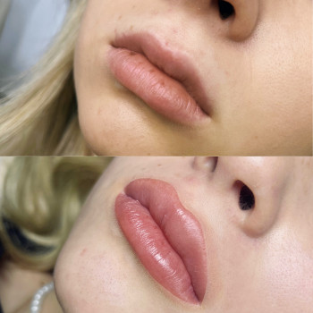 Перманентний татуаж
                    Косметолог-инъекционист Світлана Каменец-Подольский