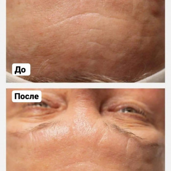 Фото из портфолио косметолога Юлія Кушнір (Луцк)