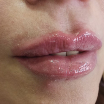 Збільшення объема губ
                    Перукар-візажист Елена Харків