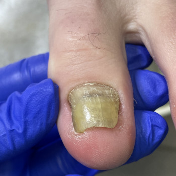 До взяття матеріалу