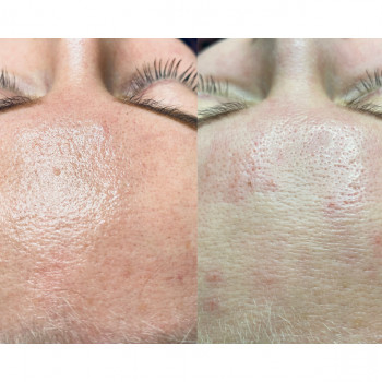 Олена Зима, Днепр Фото - 8