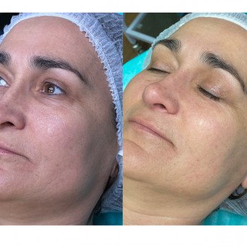 Олена Зима, Днепр Фото - 9