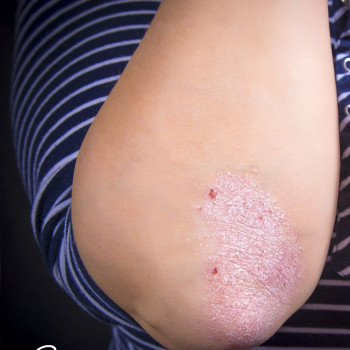 Наталія Желудкова, Одеса Фото - 8