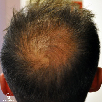 Наталія Желудкова, Одеса Фото - 9