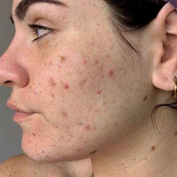 Наталія Желудкова, Одеса Фото - 13