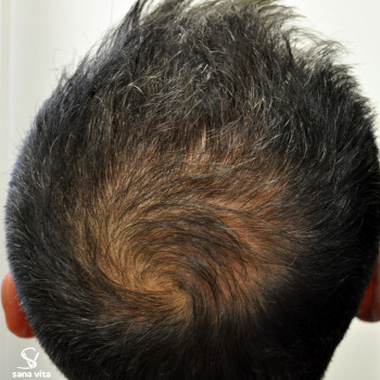 Наталія Желудкова, Одеса Фото - 16