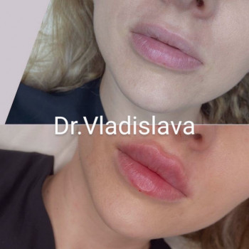 Владислава Звалинська, Ивано-Франковск Фото - 5