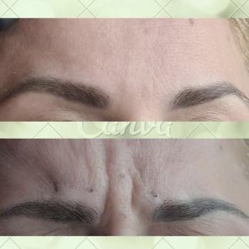 Наталія Басараб, Мукачево Фото - 5