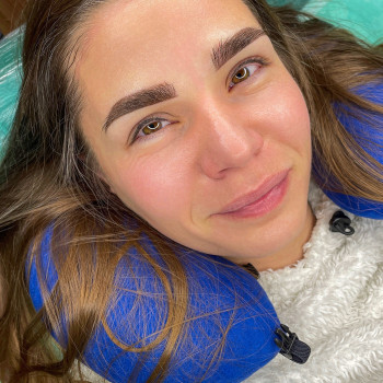 Одразу після процедури