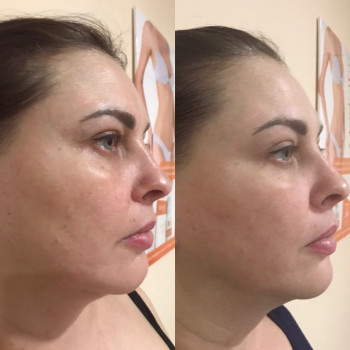 Масаж обличчя
                    Косметолог Ольга Київ