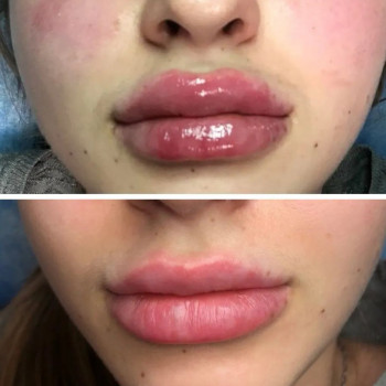 Наталья Анжуйская, Запоріжжя Фото - 27