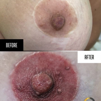 3д тату ареоли
                    Майстер перманентного макіяжу Мирослава Кропивницький