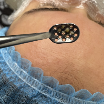 Яна Байдак, Вінниця Фото - 14