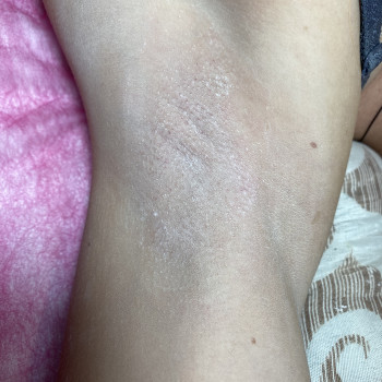 Тетяна Шейко, Охтирка Фото - 25