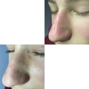 Кристина Маркиш, Кременчук Фото - 5