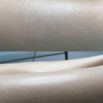 Вікторія Авдєєва, Кропивницкий Фото - 78