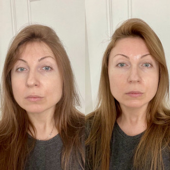 До                  Після