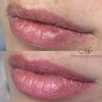 Заживші губи