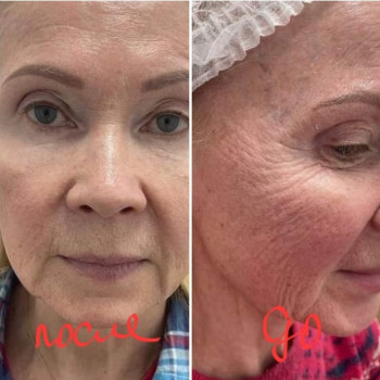 Лара Курас, Одесса Фото - 22