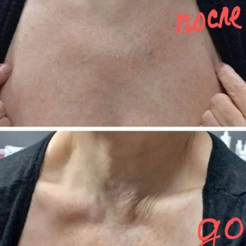 Лара Курас, Одесса Фото - 24