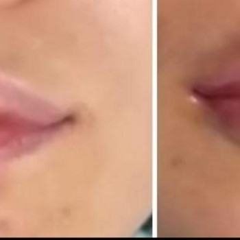 Лара Курас, Одесса Фото - 19