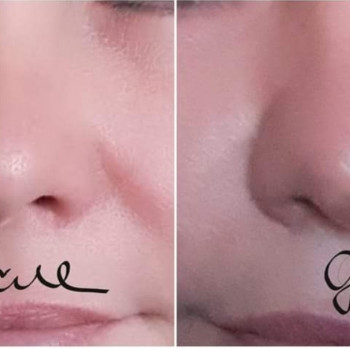 Лара Курас, Одесса Фото - 25