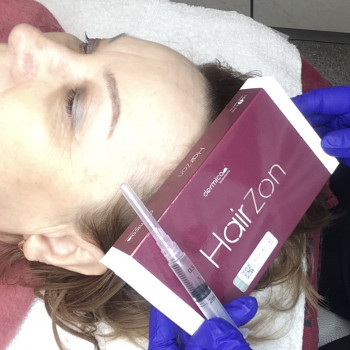 Мезотерапия волос
                    Косметолог Анна Харьков