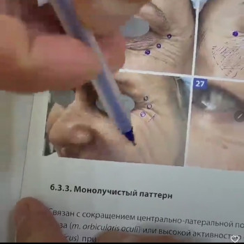 Лара Курас, Одесса Фото - 30