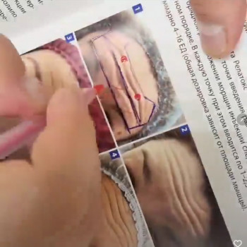 Лара Курас, Одесса Фото - 31