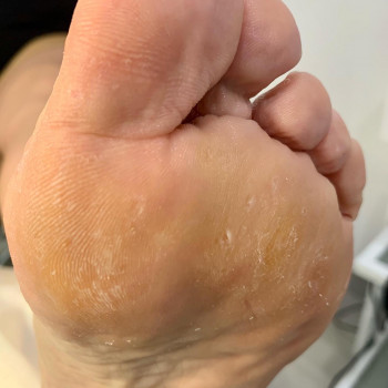 Подологія 
До