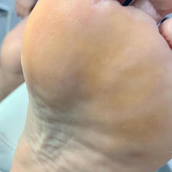 Подологія після