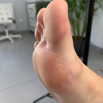 Подологія після