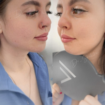 Оля Скульська, Тернополь Фото - 24