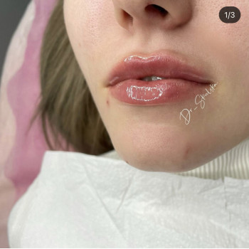 Оля Скульська, Тернополь Фото - 29