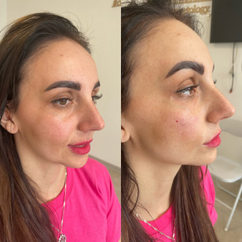 Оля Скульська, Тернополь Фото - 38