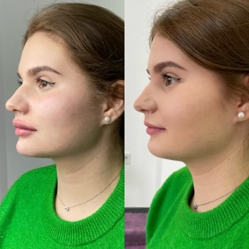 Оля Скульська, Тернополь Фото - 39