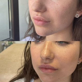 Оля Скульська, Тернополь Фото - 35