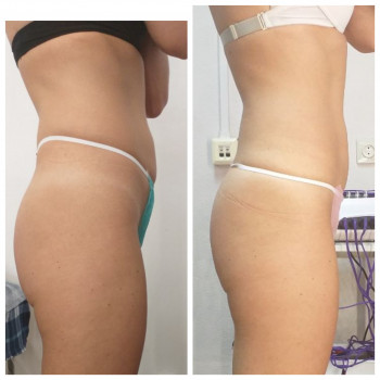 Popa Kak Orex, Павлоград Фото - 5