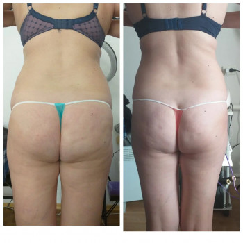 Popa Kak Orex, Павлоград Фото - 6