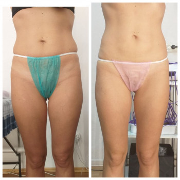 Popa Kak Orex, Павлоград Фото - 7