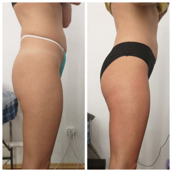 Popa Kak Orex, Павлоград Фото - 9