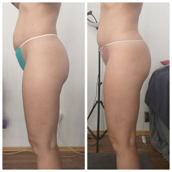 Popa Kak Orex, Павлоград Фото - 10